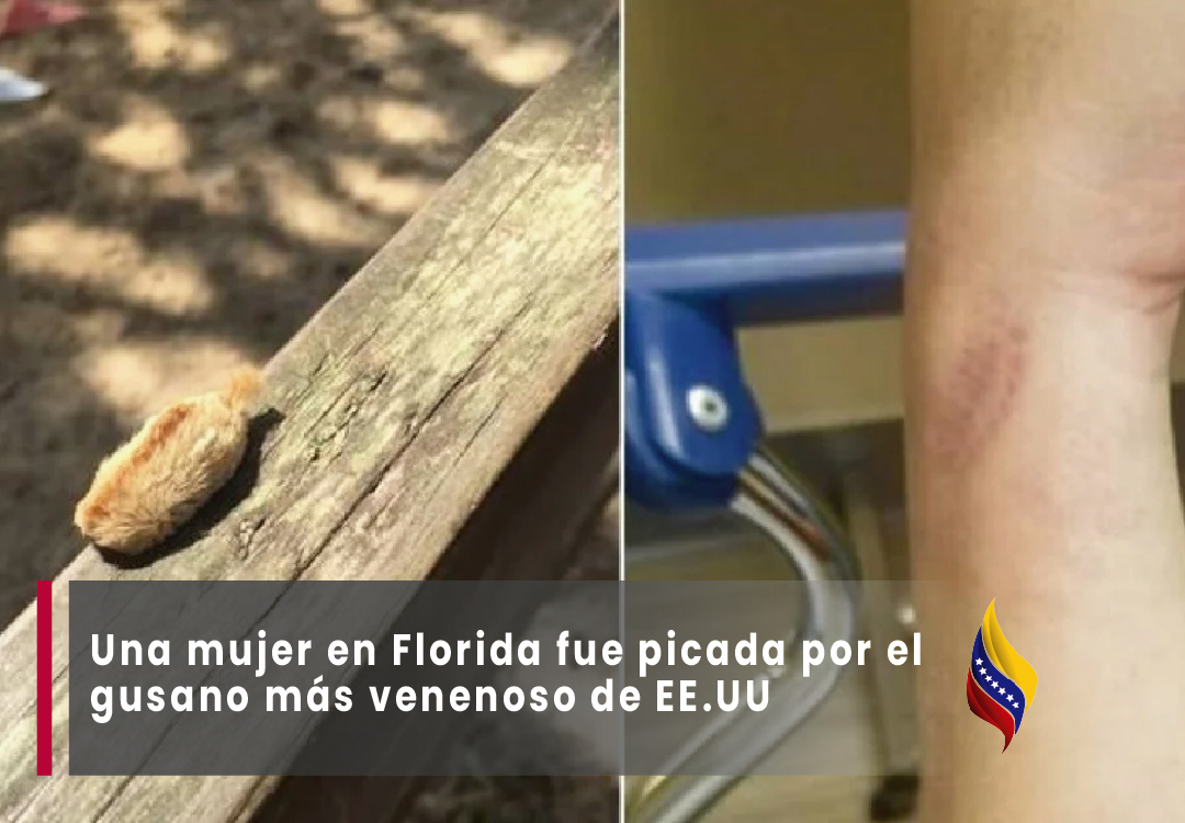 Una mujer en Florida fue picada por el gusano más venenoso de EE.UU